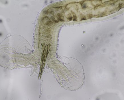 Nature’s vampire: Barber’s Pole worm